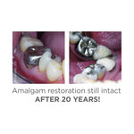 Amalgambond Plus Complete Kit: Premium Dental Bonding S370