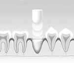 Collagen-Based Foundation Material, Medium, 15mm x 25mm 27-500200