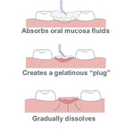HemoStat SafeGauze Topical Hemostatic Dressing is a sterile, woven, pH neutral 4900-STAT