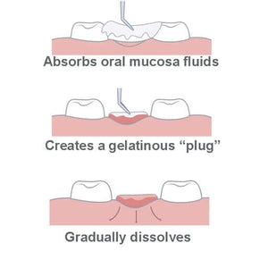 HemoStat SafeGauze Topical Hemostatic Dressing is a sterile, woven, pH neutral 4900-STAT