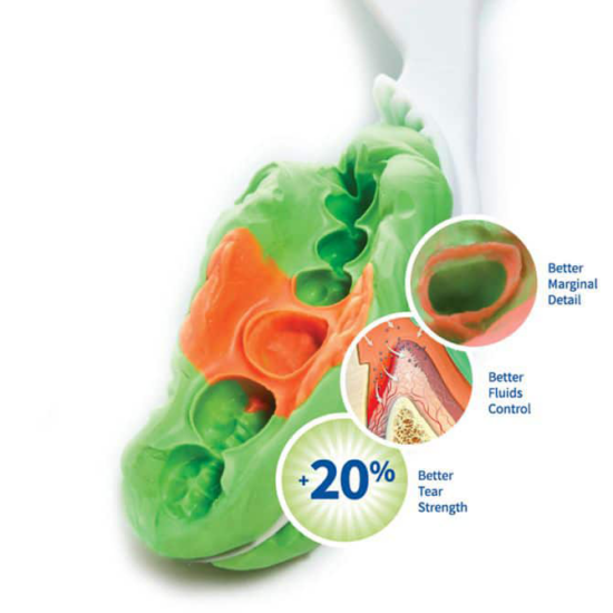 Centrix NoCord Wash Material - Self-Retracting Impressioning System