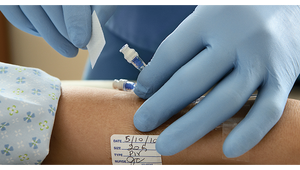 BD SmartSite 2000E Needleless Connector Negative Displacement Valve for IV Therapy, Monoport & Tri-port 2000E-1