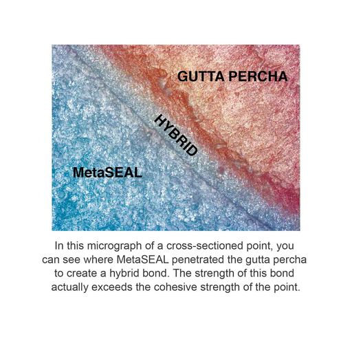 MetaSEAL Endodontic Sealer Kit S160