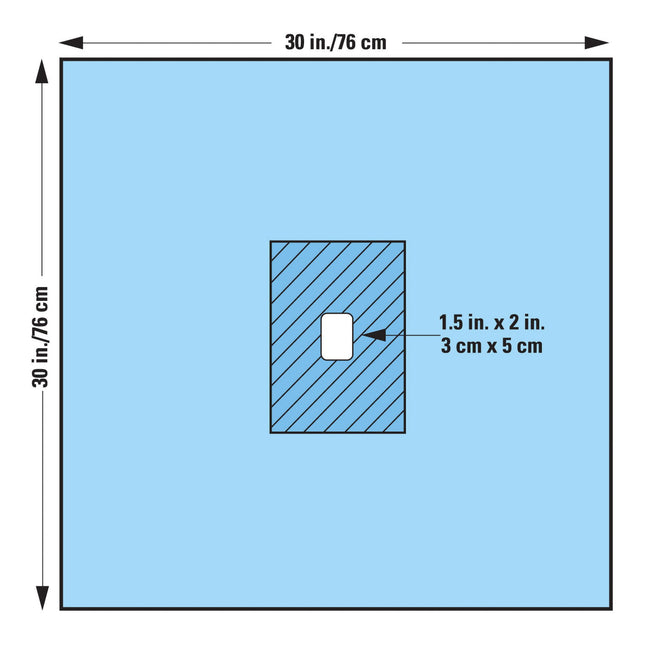 O&M Halyard Inc | Surgical Drape Minor Procedure Drape 30 W X 30 L Inch Sterile | 89206