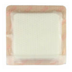 Securement Device: 2" x 21/8, Securement Dressing: 4" x 61/8" 1879-2100-80