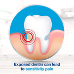 Sensodyne Extra Whitening Fluoride Toothpaste for Sensitive Teeth, 4 ct. 253599