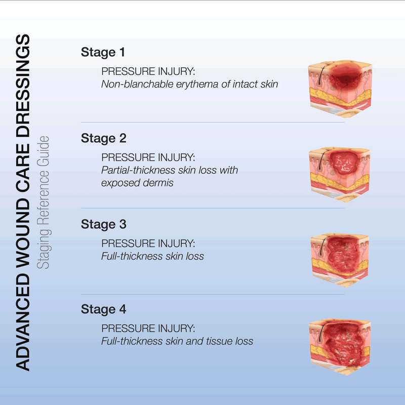 Dynarex CuraFoam Foam Dressings 3011