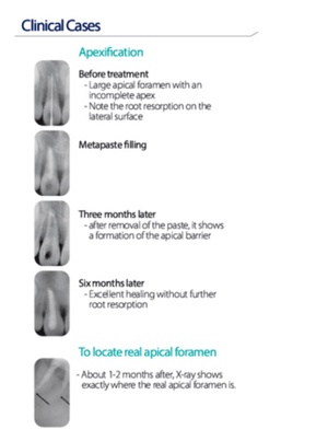 Metapaste Plus 301002